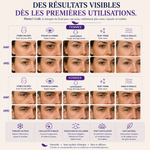 Masque Cryo Beauty PlumeX™ | Beauté par le Froid • Raffermit • Décongestionne • Anti-Migraine