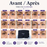 Masque Cryo PlumeX™ | Beauté par le Froid • Raffermit • Décongestionne • Anti-Migraine